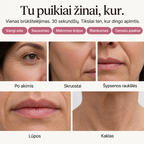 AUŠRA — Ląstelių atsinaujinimas be adatų
